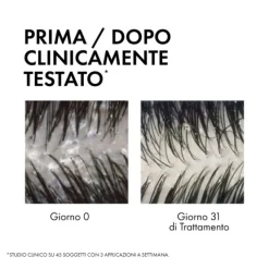 Vichy Dercos Trattamento Antiforfora 2In1 Shampoo+Balsamo 400Ml