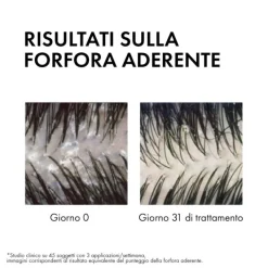 Vichy Dt Shampoo Antiforfora Ds Capelli Da Normali A Grassi 200 Ml
