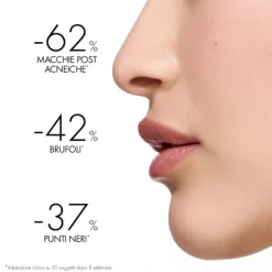 Vichy Normaderm Trattamento Idratante Doppia Azione 50 Ml Trattamenti Acne
